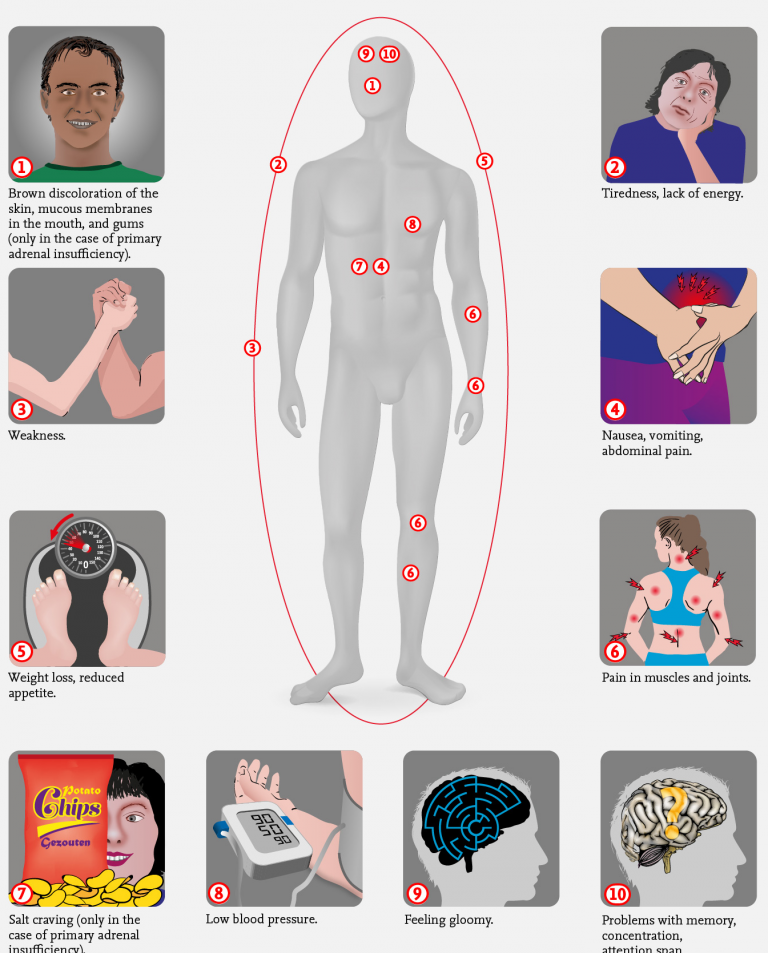 adrenal-insufficiency-infographic-adrenals-eu