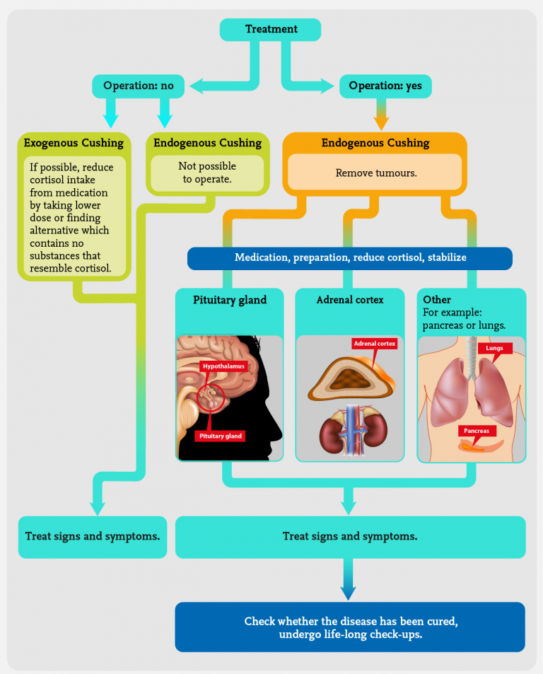 Cushing's syndrome infographic Adrenals.eu