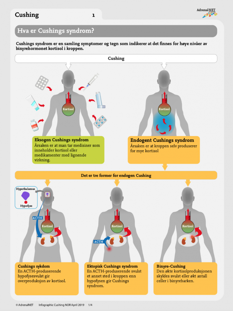 Cushings Syndrom Infographic - Adrenals.eu