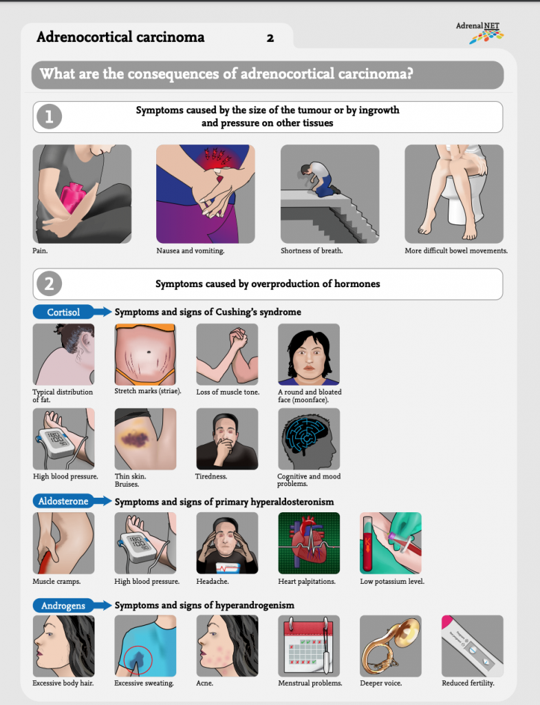 Infographic Adrenal carcinoma - Adrenals.eu