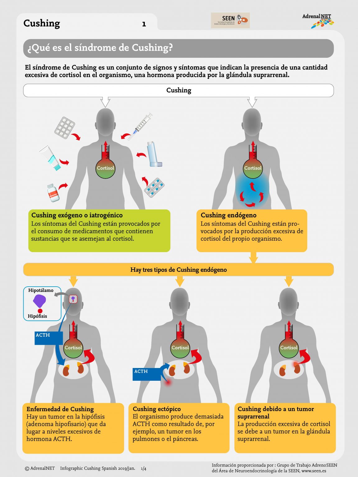 Infografía Del Síndrome De Cushing - Adrenals.eu